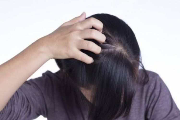Ini Cara Aman Basmi Kutu Rambut, Biar Rambut Tidak Botak