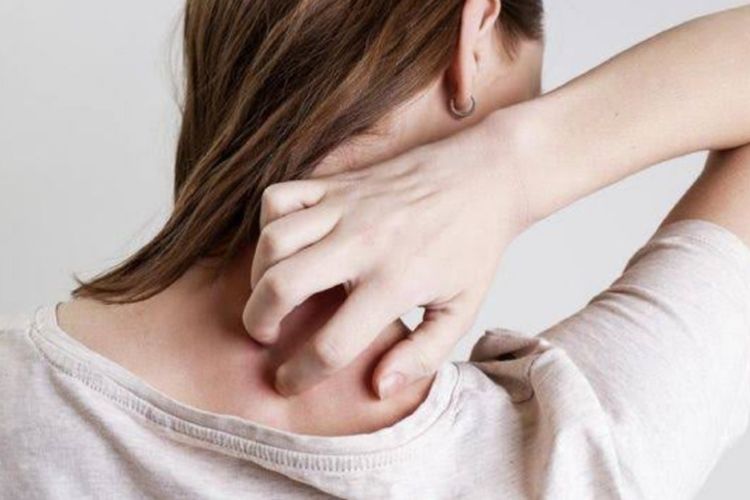 Panuan? Ini 5 Bahan Alami Ampuh jadi Obat Panu