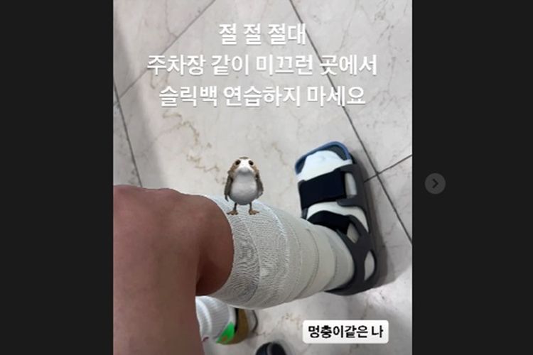 Gara-gara ‘Slick Back Challenge’, Aktris Jeon Hye Bin Alami Cedera di Kakinya