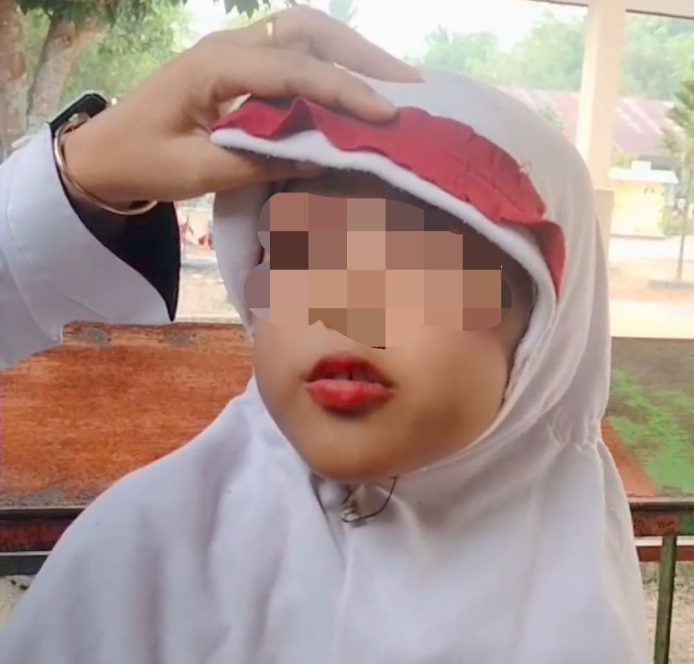 Bocah 7 Tahun di Ogan Ilir Diduga Dianiaya Ibu Kandung, Polisi Masih Menunggu Laporan Resmi