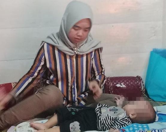Dapat KIS, Pemkot Jamin Pengobatan Bayi Hipospadia di Palembang