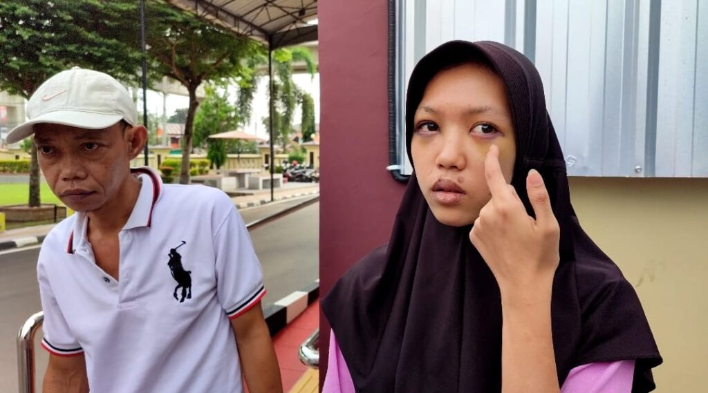 Alami Penyiksaan Brutal, Ibu Muda di Palembang Laporkan Suami Siri ke Polisi