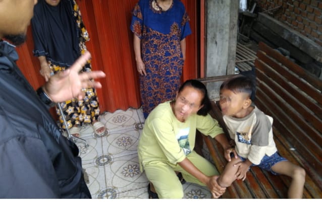 Bocah 6 Tahun di Empat Lawang Terinfeksi Rabies Usai Digigit Anjing Liar, Pemkab Segera Vaksinasi Massal