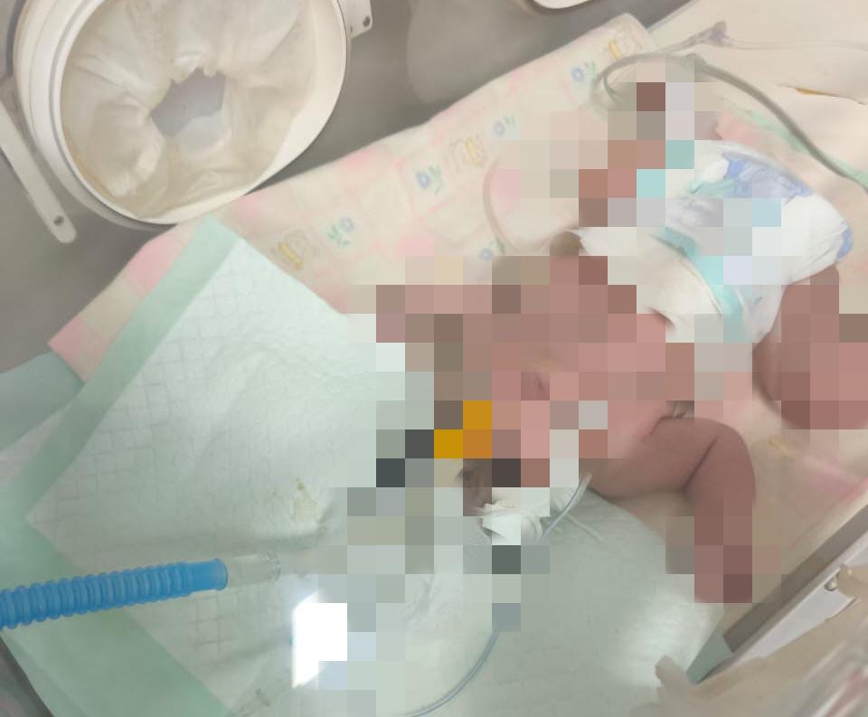 Bayi Lahir Tanpa Tempurung Kepala di Palembang, Keluarga Harapkan Uluran Tangan Dermawan