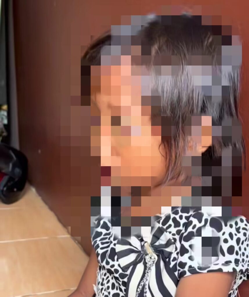 Diduga Jadi Korban Kekerasan Sekolah, Murid SD di Palembang Trauma dan Membisu