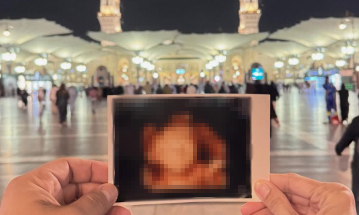 Calon Buah Hati Meninggal Dunia, Istri Rizal Armada Unggah Tulisan Haru ‘Love You Nak’