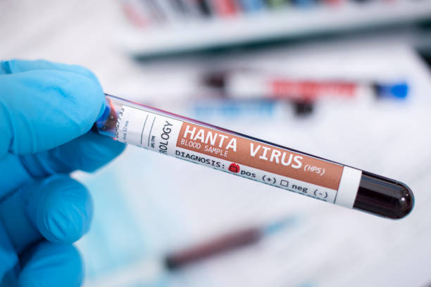 Sumsel Nihil Kasus Hantavirus, Dinkes Minta Warga Waspada Tikus di Lingkungan Rumah