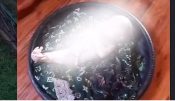Bayi Berkaki Menyatu Mirip Putri Duyung Lahir di Bangka, Orang Tuanya Warga OKI